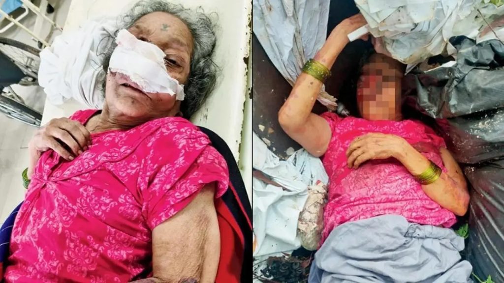 कूड़े के ढेर में फेंका अपनी ही दादी को